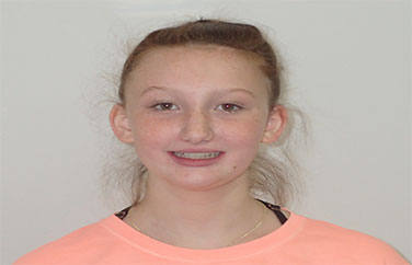 Hailey-Brant-Frontal-Smile2018